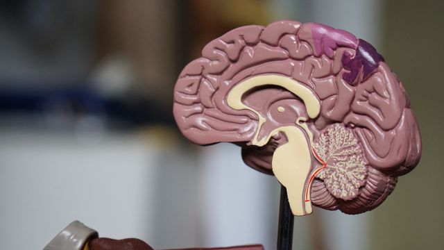 Anatomical brain model highlighting blood vessels, used to study brain aneurysms. 